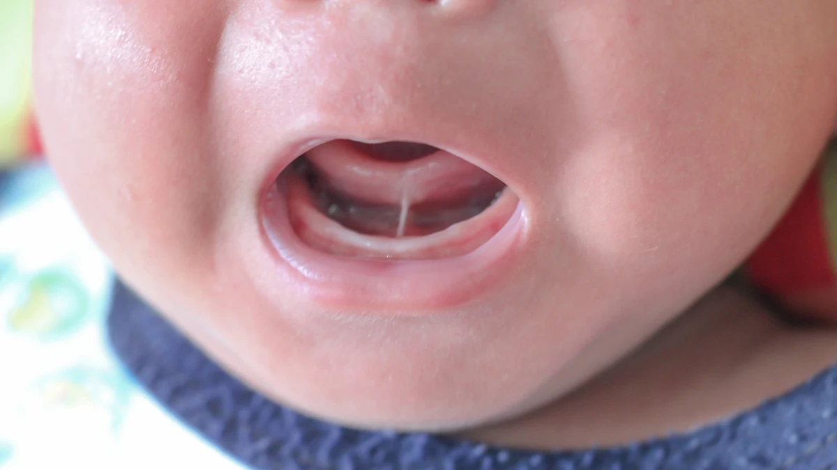Cortar el frenillo lingual alarga la lactancia materna