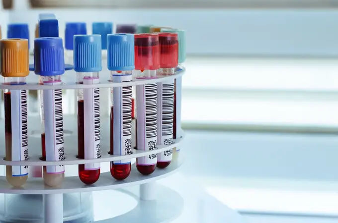 Un análisis de sangre permitirá saber si tienes más riesgo de sufrir un ictus 