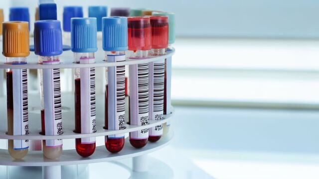 Análisis de sangre