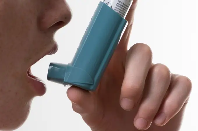 Los neumólogos solicitan la eliminación del triple visado para el acceso a la terapia de asma grave