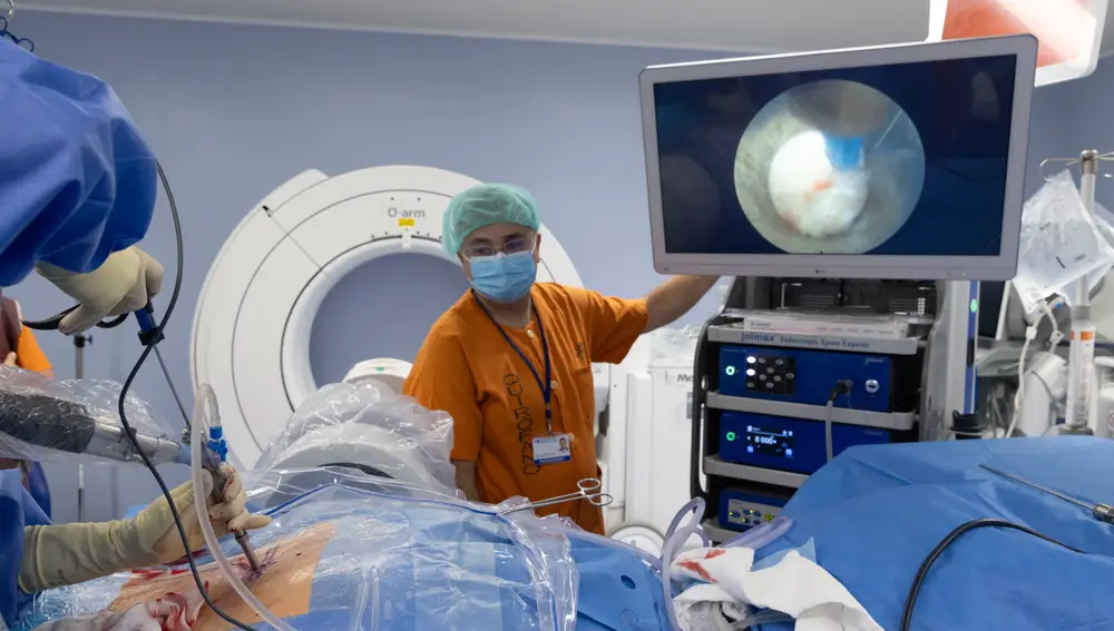 El doctor Castrillo utiliza la cámara endoscópica y una herramienta de entre 1 y 3 milímetros para operar una estenosis de canal a través de la técnica de la endoscopia de columna el pasado martes 25 de julio en el Hospital Ramón y Cajal de Madrid