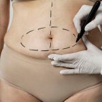 Un cirujano estudia el abdomen de una mujer