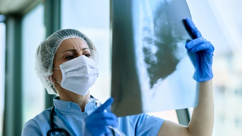 Radiografía de pulmón