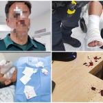 Imágenes de algunos de los agentes heridos durante el asalto al cuartel de la Guardia Civil en Chiclana de la Frontera