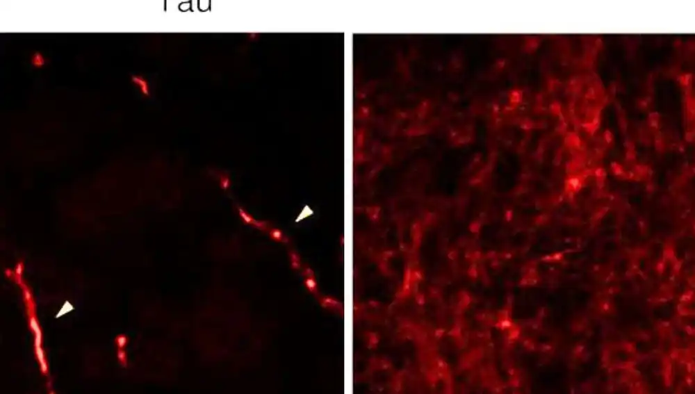Imágenes confocales de secciones transversales de cerebro de ratones no infectados (izq) o infectados con la cepa B.1. (dcha)