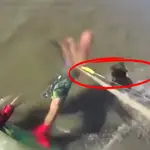Ataque de un perro a un hombre en una playa de Argentina