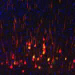 Las neuronas, en rojo y en amarillo, están entre las células más difíciles de regenerar