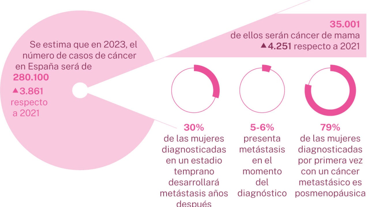 Los Casos De Cáncer De Mama No Paran De Subir Mientras La Mortalidad Baja