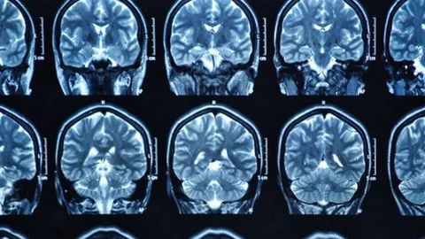 Imagen del cerebro