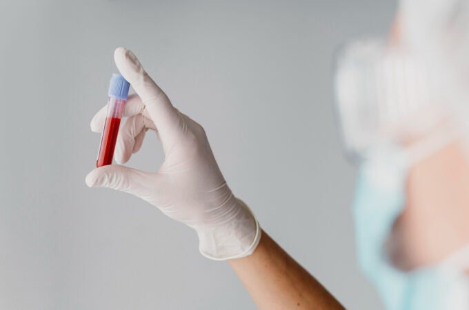 Esperan crear el primer test de sangre en detectar el cáncer de páncreas en estadios tempranos