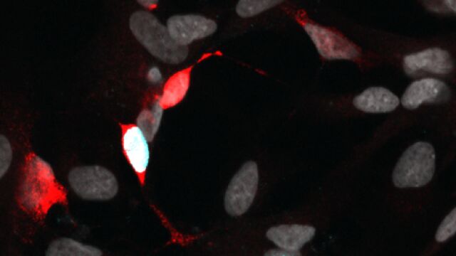 Células de Müller, en rojo. Un paso hacia recuperar células retinarias.