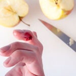 Los accidentes domésticos son más comunes de lo que parecen y un cuchillo puede provocarnos una herida poco gratificante