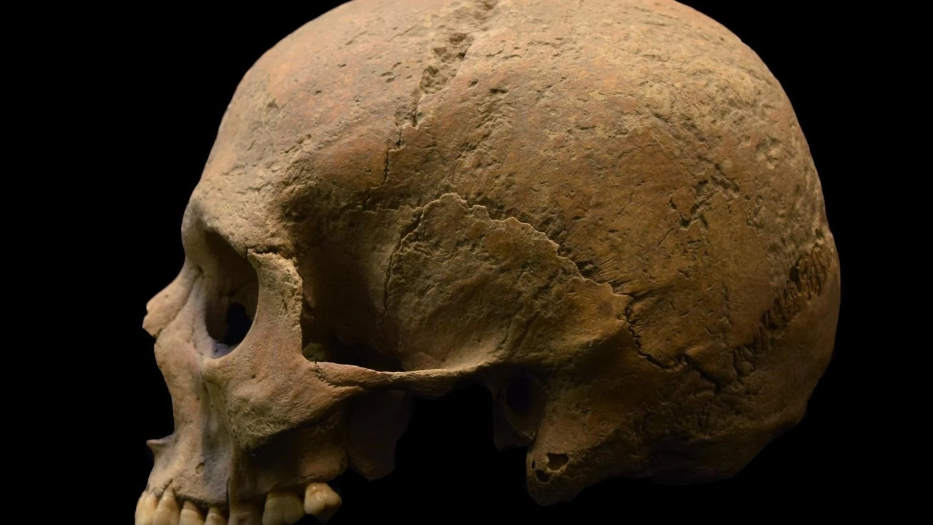 Calavera, cráneo, restos óseosLUCA BANDIOLI/PIGORINI MUSEO (Foto de ARCHIVO)05/12/2016