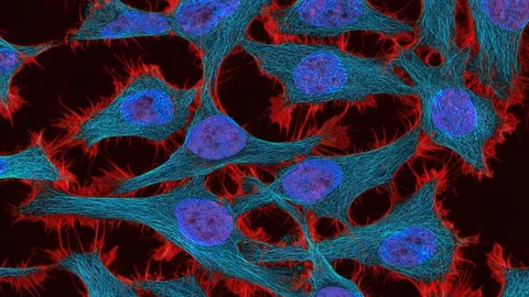 Imagen en detalle de células cancerosas en el útero