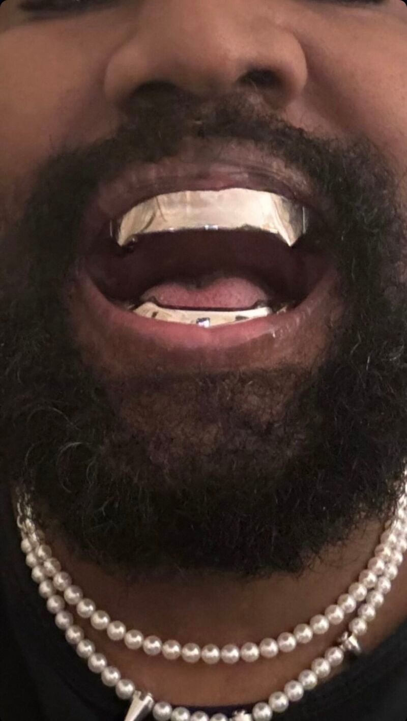 Los nuevos dientes de titanio de Kanye West