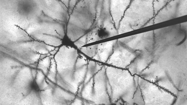 Neurona