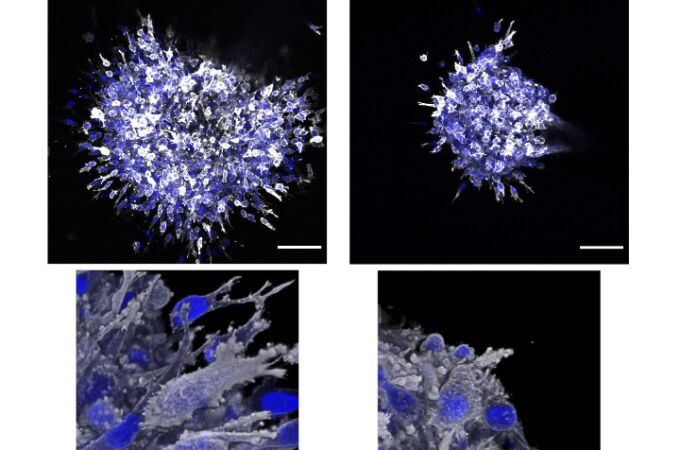 Células de cáncer de mama con la proteína SMYD2 activa (On) y desactivada (Off).
