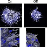 Células de cáncer de mama con la proteína SMYD2 activa (On) y desactivada (Off).