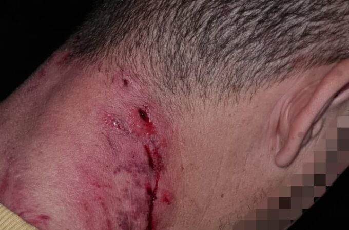 Herido un hombre en Jaén por mordeduras de un perro potencialmente peligroso
