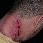 Herido un hombre en Jaén por mordeduras de un perro potencialmente peligroso