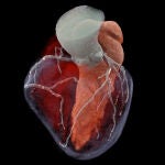 Esta tecnología, por su rapidez y gran resolución espacial, será crucial para el estudio de las arterias coronarias