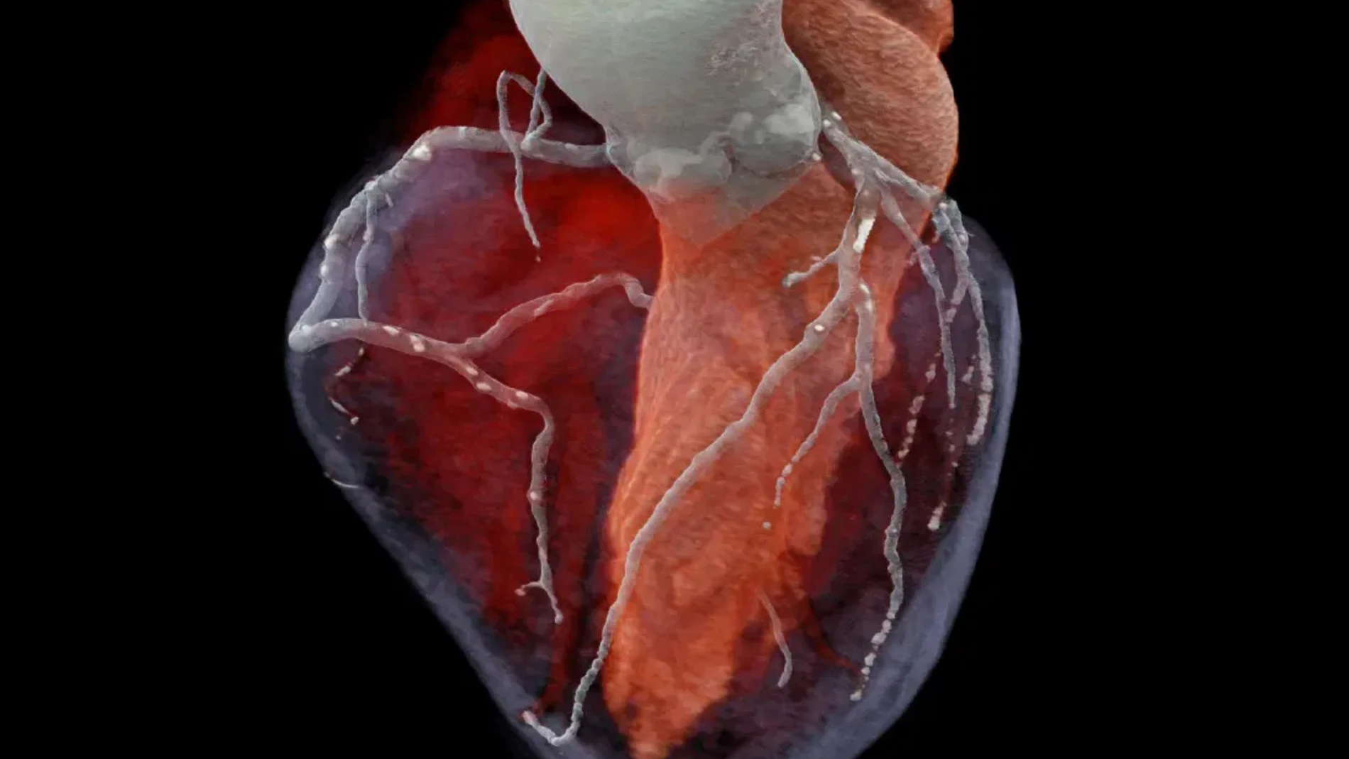 Esta tecnología, por su rapidez y gran resolución espacial, será crucial para el estudio de las arterias coronarias