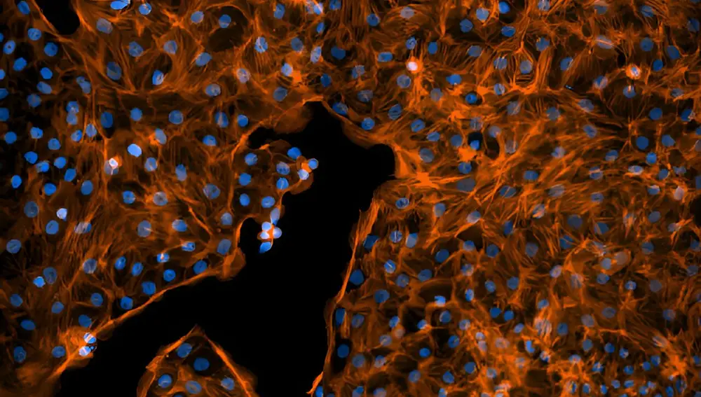 Células pulmonares fetales de rata como las utilizadas para medir el transporte de sodio. Los núcleos celulares se muestran en azul y en naranja los filamentos de actina del citoesqueleto