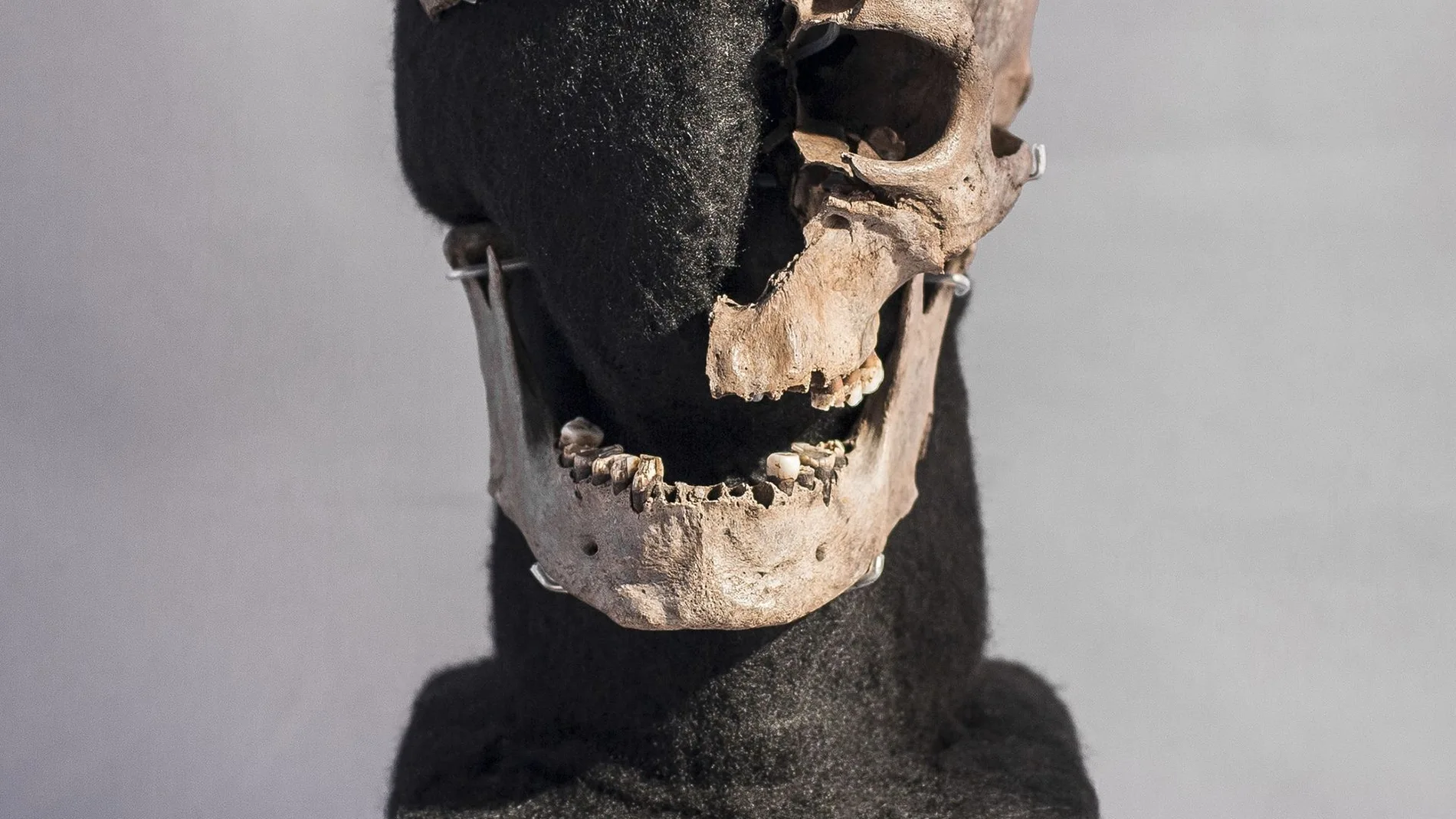 El cráneo objeto de la investigación 