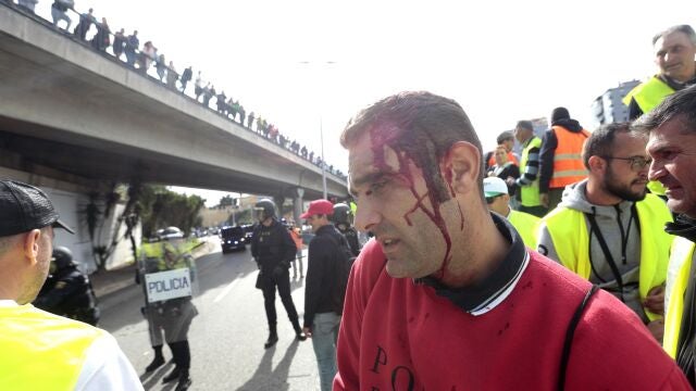 Uno de los agricultores heridos durante las cargas policiales en Algeciras 