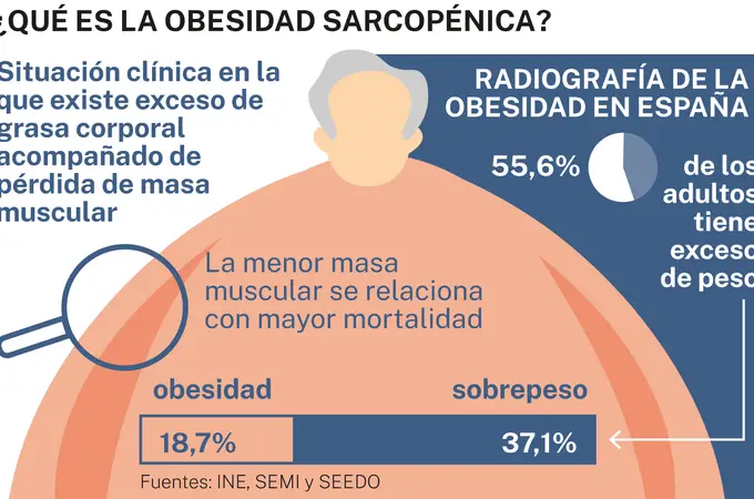 ¿Qué es la obesidad sarcopénica que aumenta el riesgo de muerte?