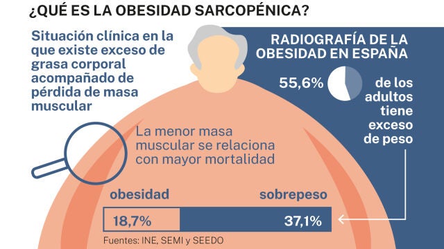 Obesidad sarcopénica