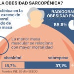 Obesidad sarcopénica