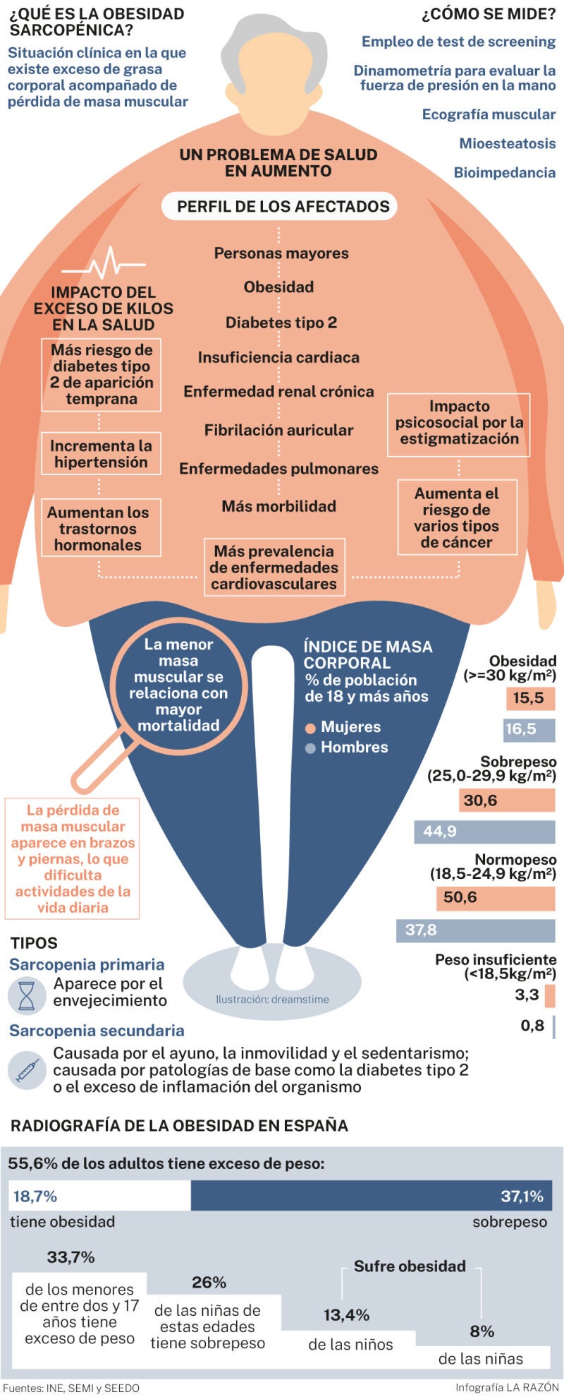 Qué es la obesidad sarcopénica