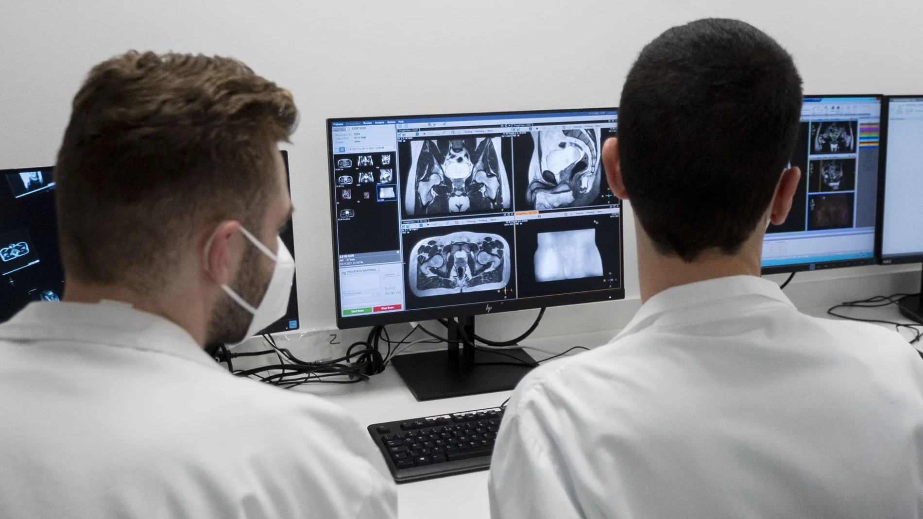 Dos técnicos controlan un sistema de radioterapia de precisión molecular guiada por resonancia magnética en el Hospital Carlos III