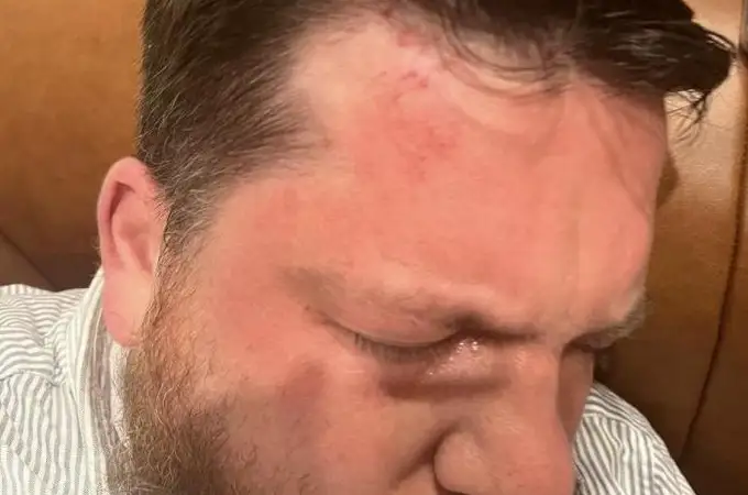 Un opositor ruso aliado de Navalni sufre un brutal ataque: fue golpeado hasta 15 veces con un martillo
