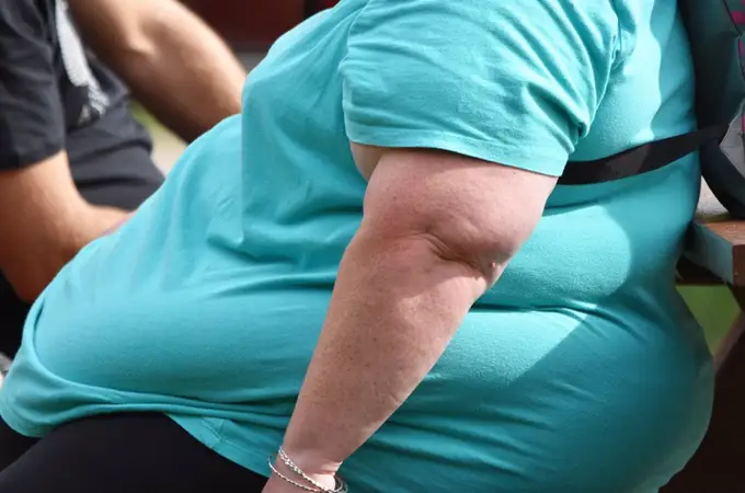 Más de 1.000 millones de personas de todo el mundo sufren obesidad