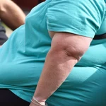 Expertos piden más concienciación en obesidad ya que solo el 42% de las personas cree que es una enfermedad crónica