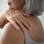 La osteoporosis afecta a 1 de cada 4 mujeres postmenopáusicas (a partir de los 50 años)