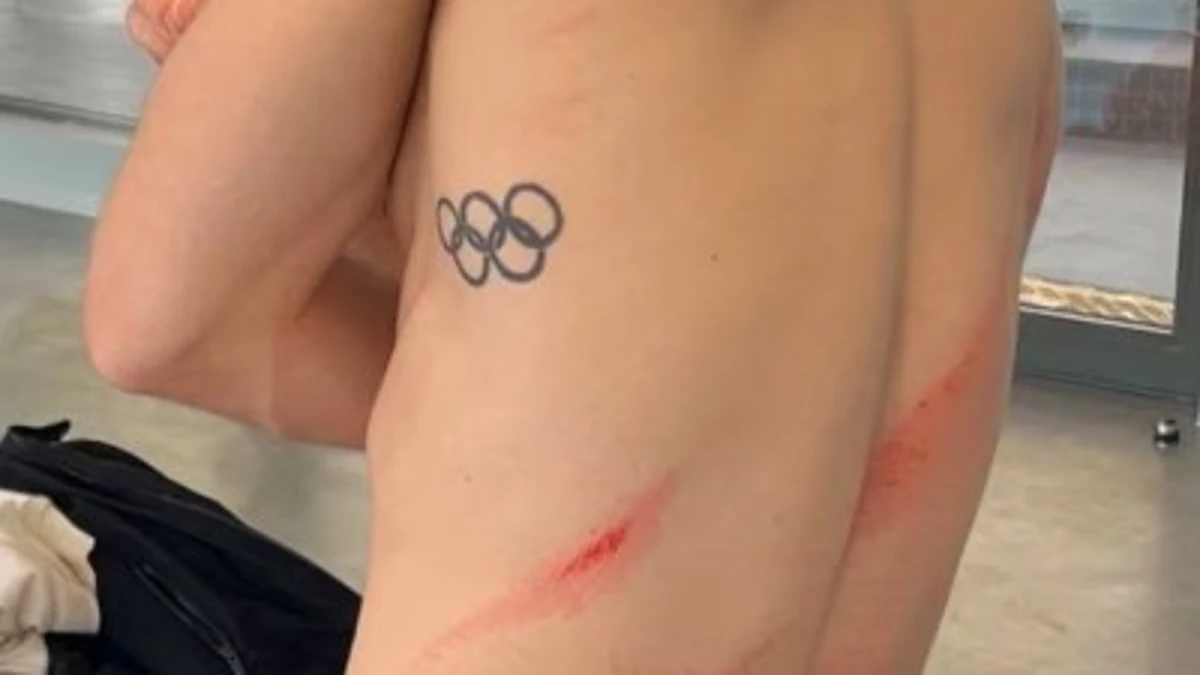 El golpetazo viral de un saltador olímpico en la inauguración de la piscina de los Juegos