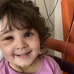 Salvan a una niña de 4 años que tenía una aguja de dentista clavada en el cerebro 