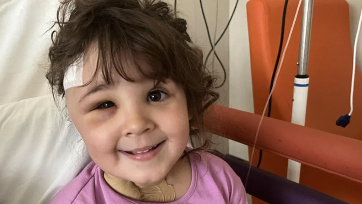 Salvan a una niña de 4 años que tenía una aguja de dentista clavada en el cerebro
