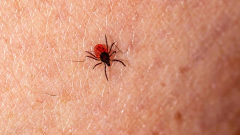 La Enfermedad de Lyme se produce por una bacteria transmitida por la picadura de garrapatas infectadas