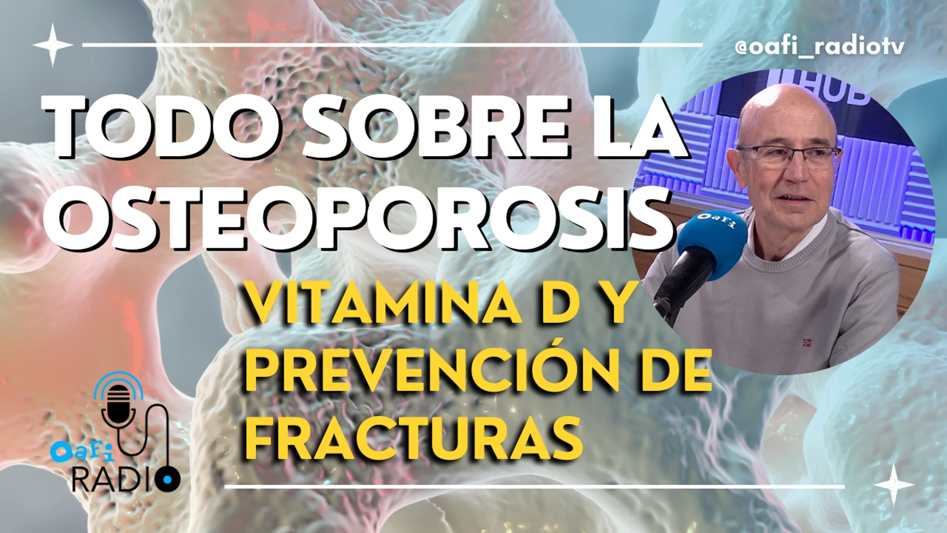 Oafi Radio, el podcast sobre salud de la Fundación Internacional de la Artrosis del 6 de mayo de 2024