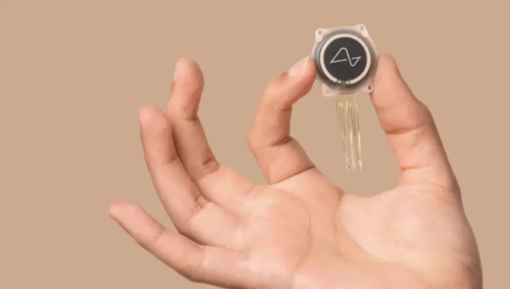 El primer chip de Neuralink implantado en el cerebro de un humano comienza a desprenderse.