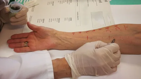 Se estima que entre el 25% y el 30% de la población tiene algún tipo de alergia