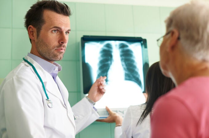 El neumococo afecta a pulmones y corazón