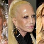 Antes y después de Donatella Versace