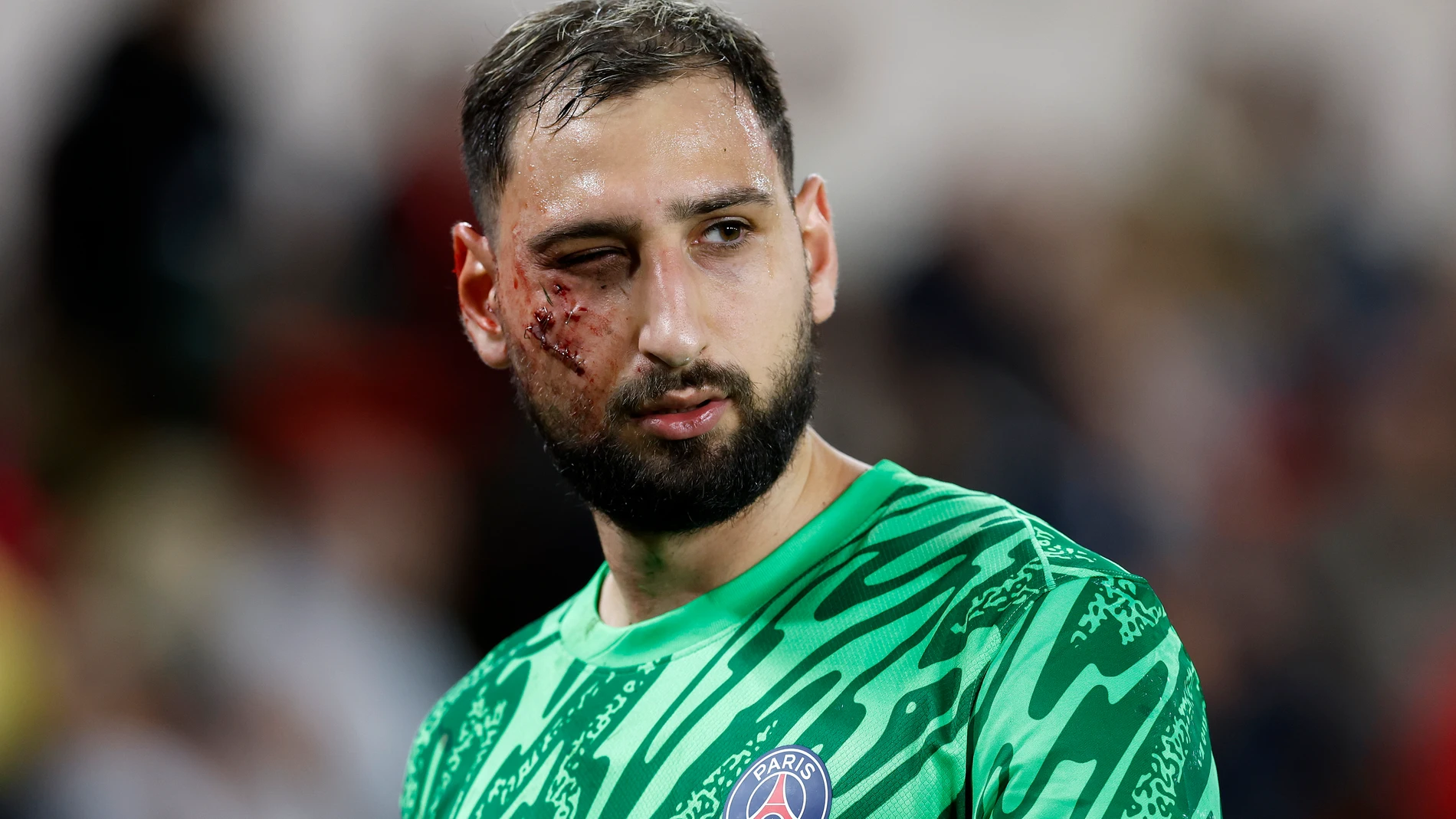 Donnarumma tras la lesión