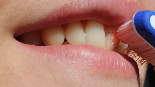 El truco para eliminar el sarro de los dientes desde casa y sin dolor 