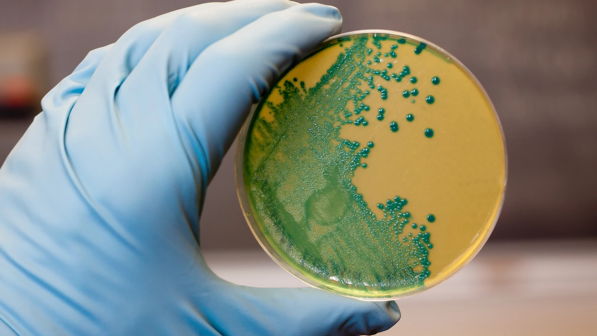 Listeria monocytogenes que crece en una placa de aga